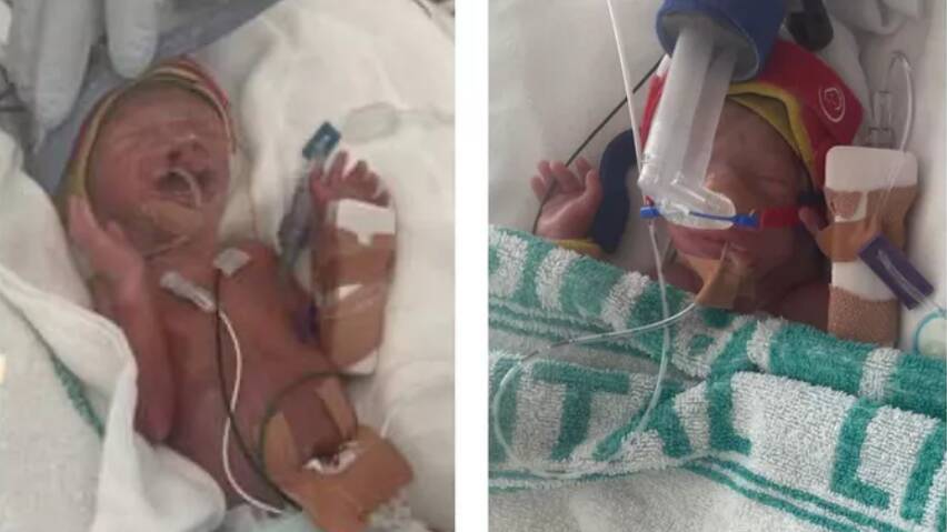 Ganmain parents Josh and Britt Hey welcomed their twin boys Noah and Ryan early at just 25 weeks. They are now in the NCIU at Canberra Hospital. Picture supplied 